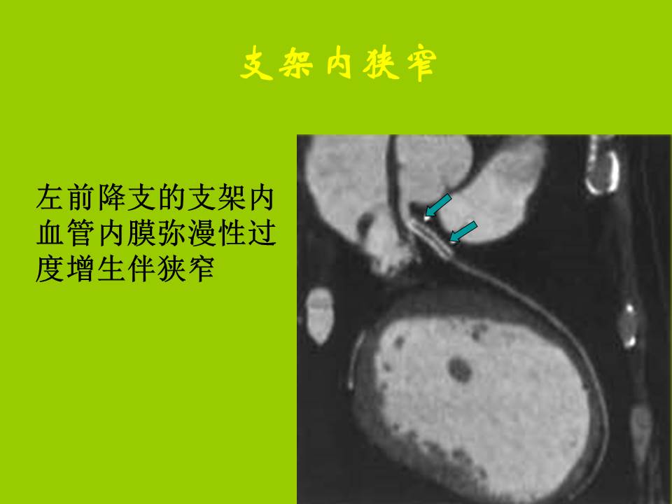 幻灯片54