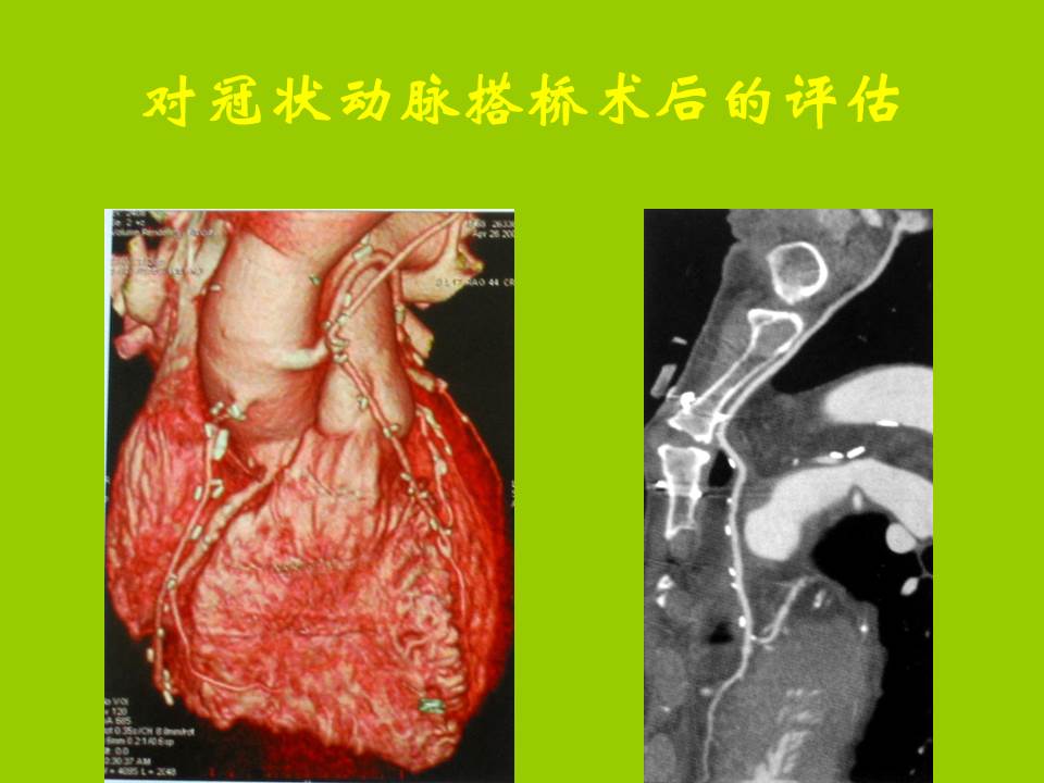 幻灯片56