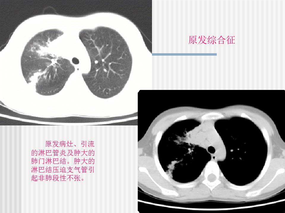 幻灯片13