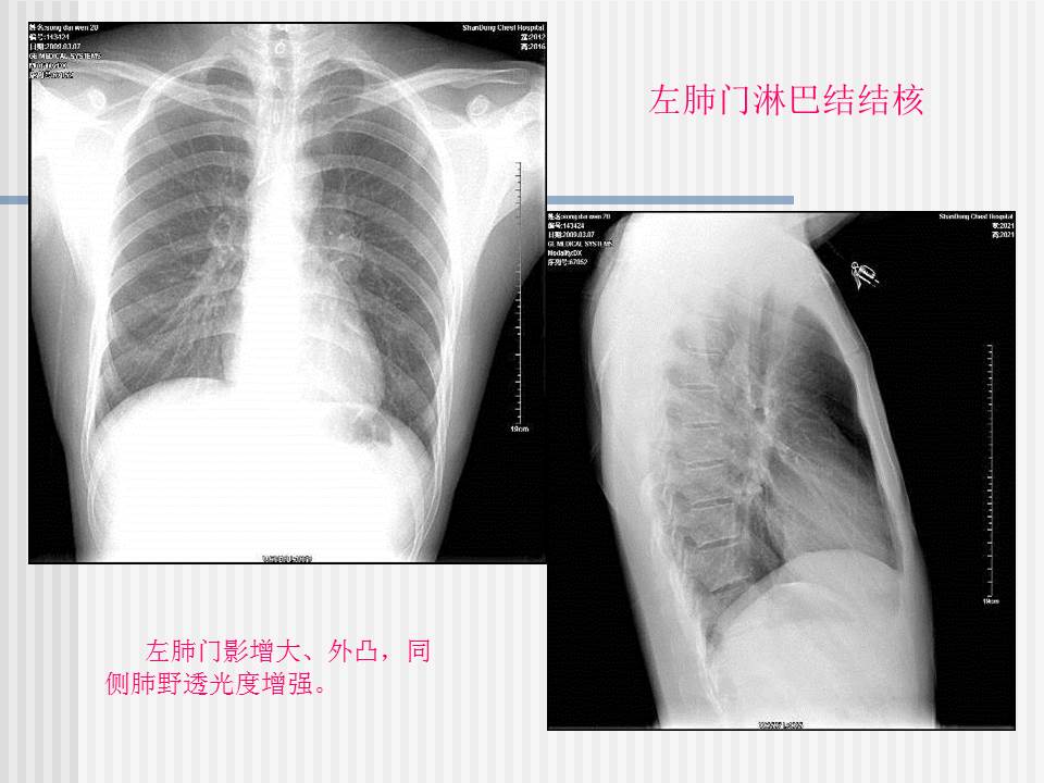 幻灯片14