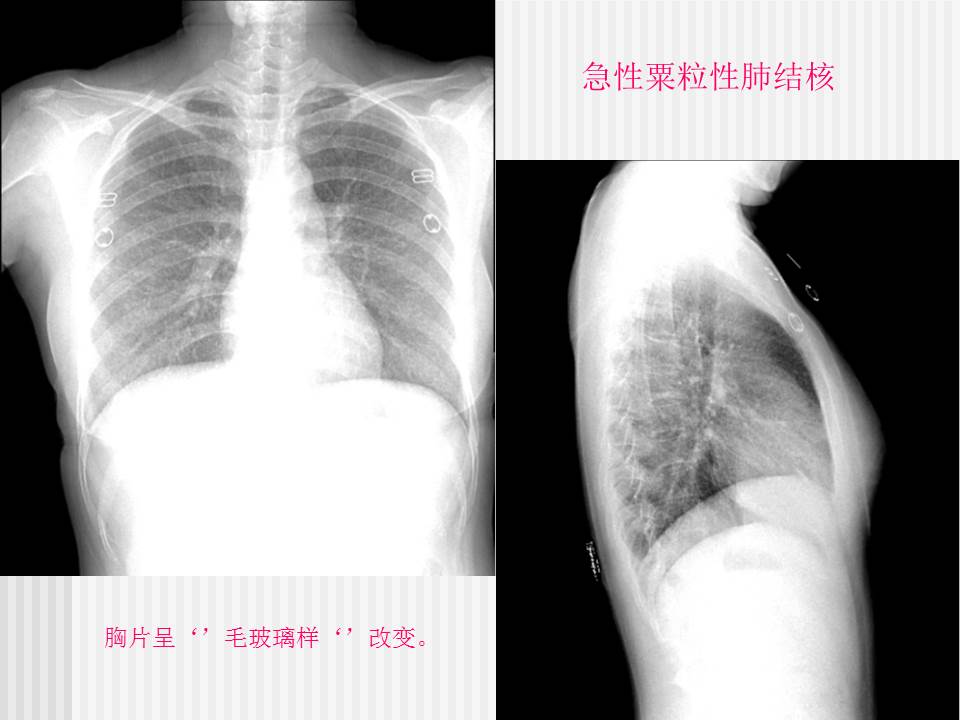 幻灯片19