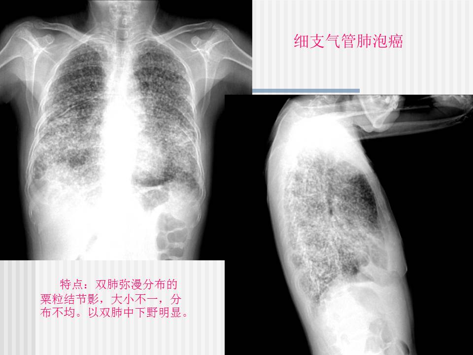 幻灯片22