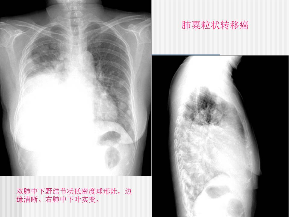 幻灯片24