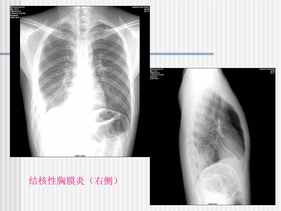 幻灯片56