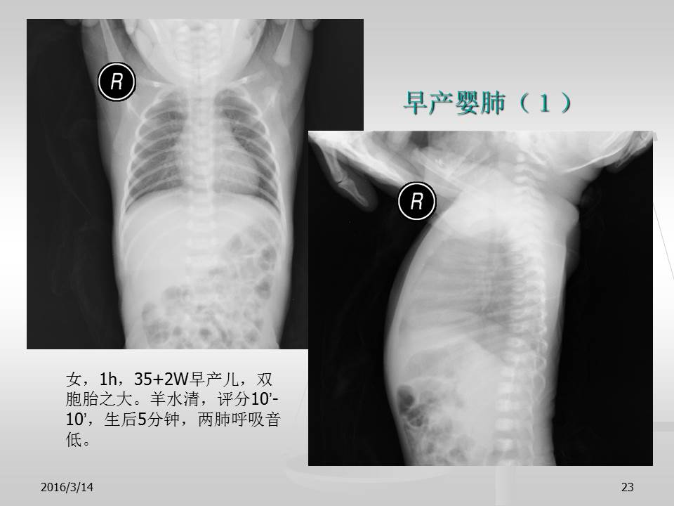 幻灯片23