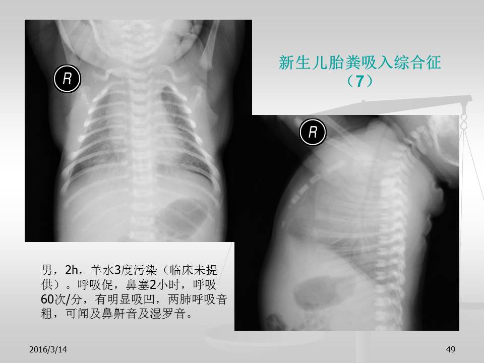 幻灯片49