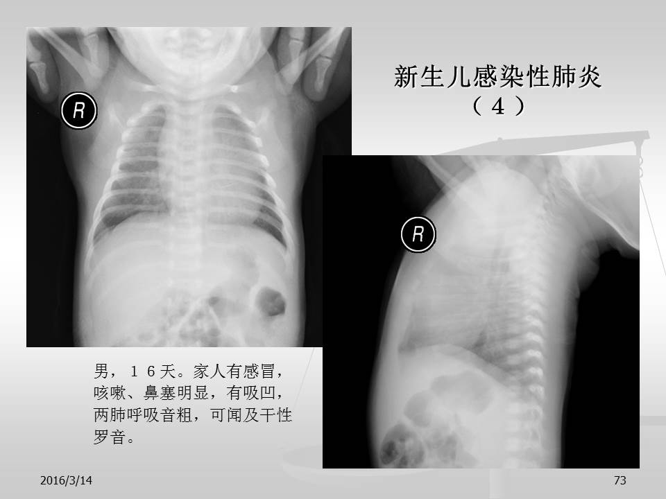 幻灯片73