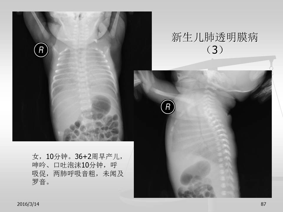 幻灯片87