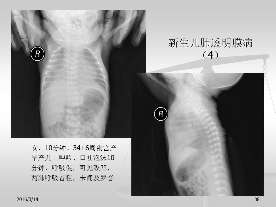 幻灯片88