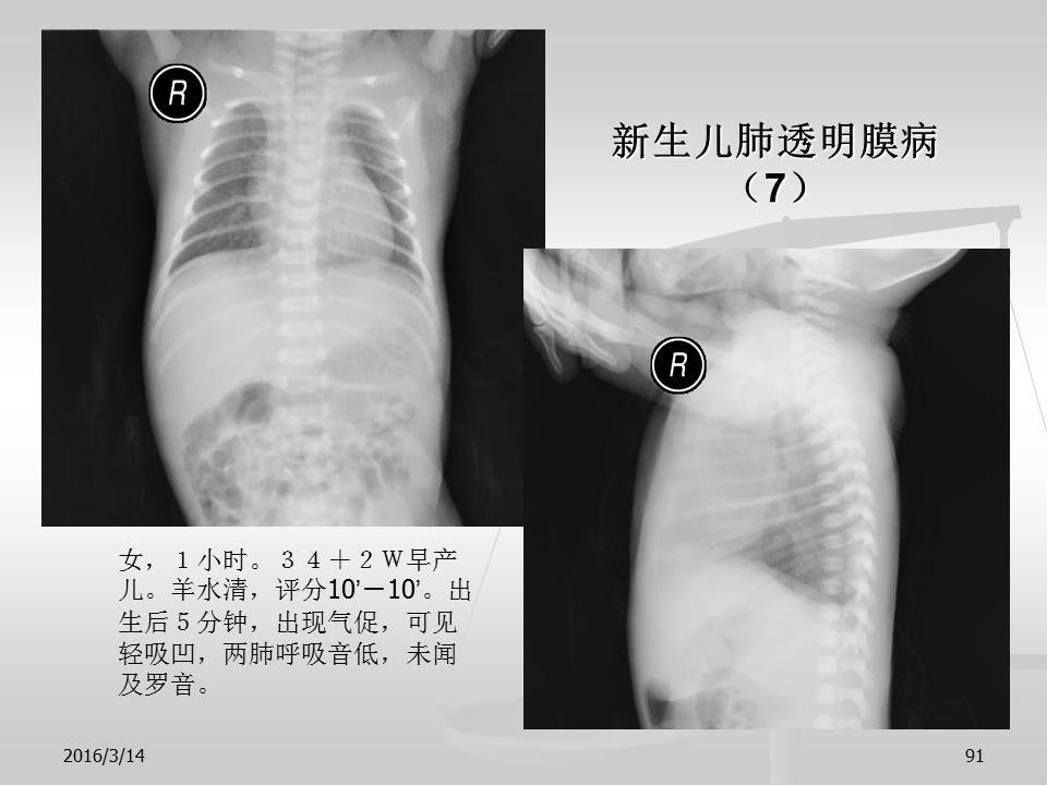 幻灯片91