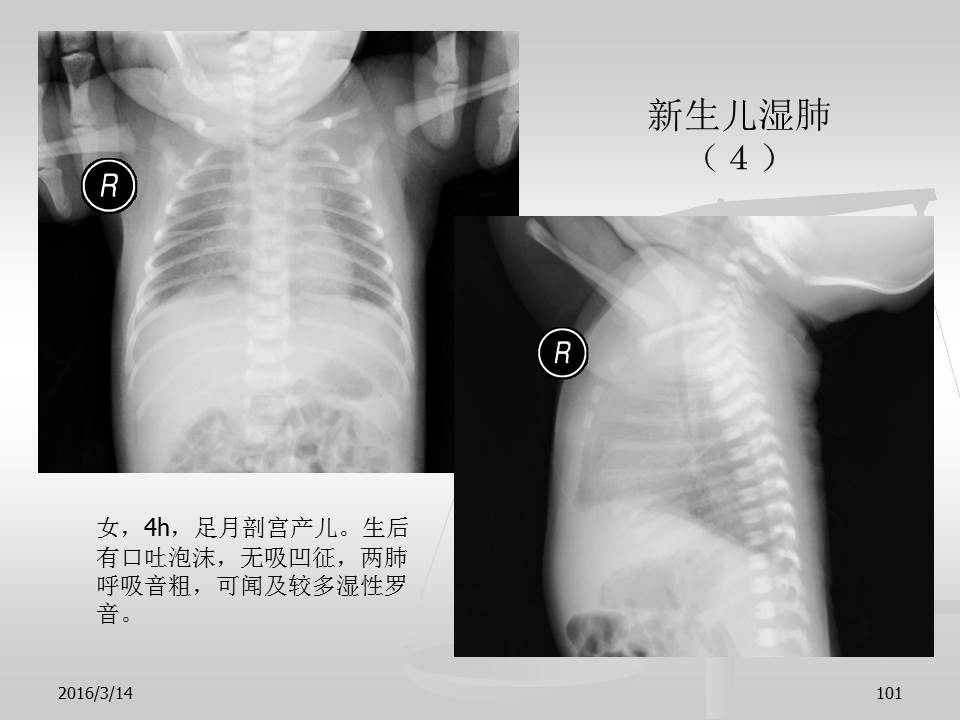 幻灯片101