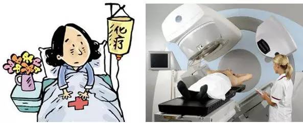 肺部毛玻璃样变=肺癌？一文解析你不知道的 GGO