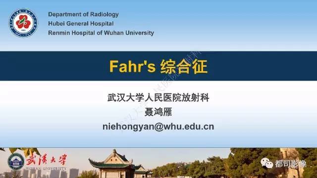 【PPT】Fahr’s综合征
