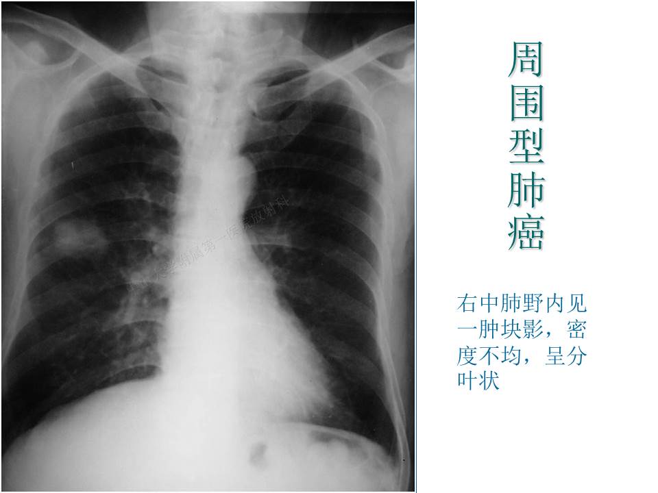 幻灯片22