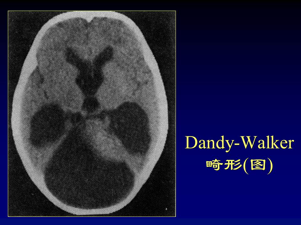 幻灯片35