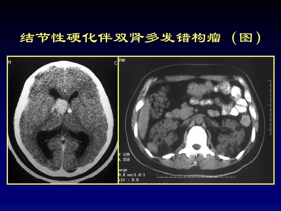 幻灯片93