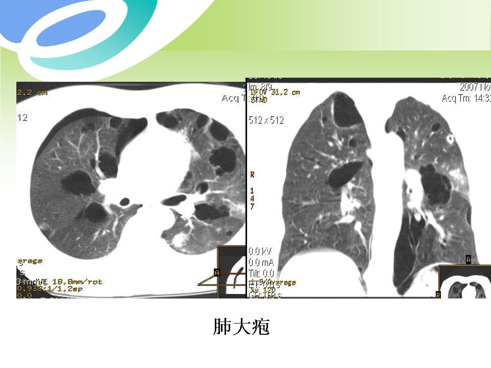 幻灯片25