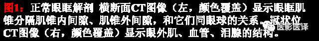 成人眼眶肿瘤：临床、影像、与病理回顾