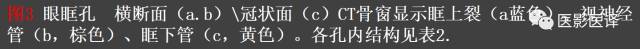 成人眼眶肿瘤：临床、影像、与病理回顾