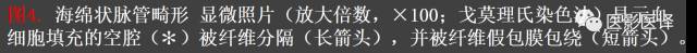 成人眼眶肿瘤：临床、影像、与病理回顾