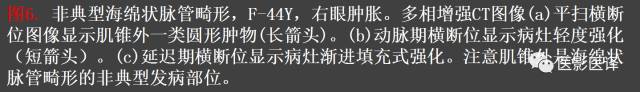 成人眼眶肿瘤：临床、影像、与病理回顾