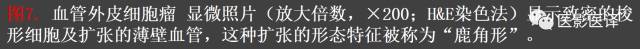 成人眼眶肿瘤：临床、影像、与病理回顾