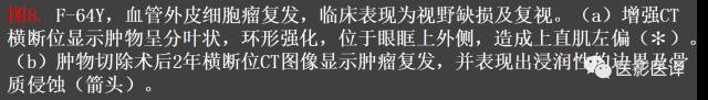 成人眼眶肿瘤：临床、影像、与病理回顾
