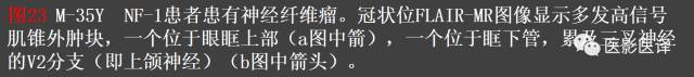 成人眼眶肿瘤：临床、影像、与病理回顾