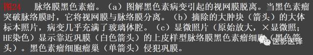 成人眼眶肿瘤：临床、影像、与病理回顾