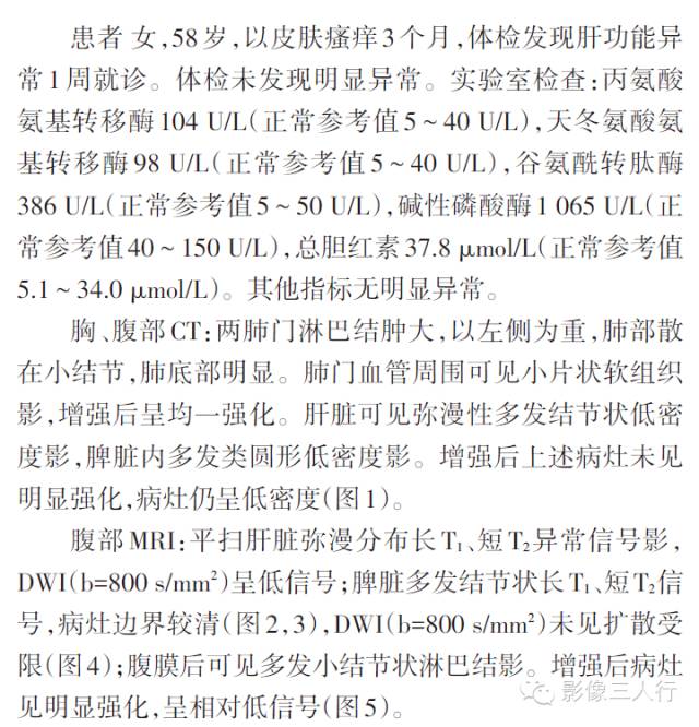 【病例】肝脏结节病一例影像表现