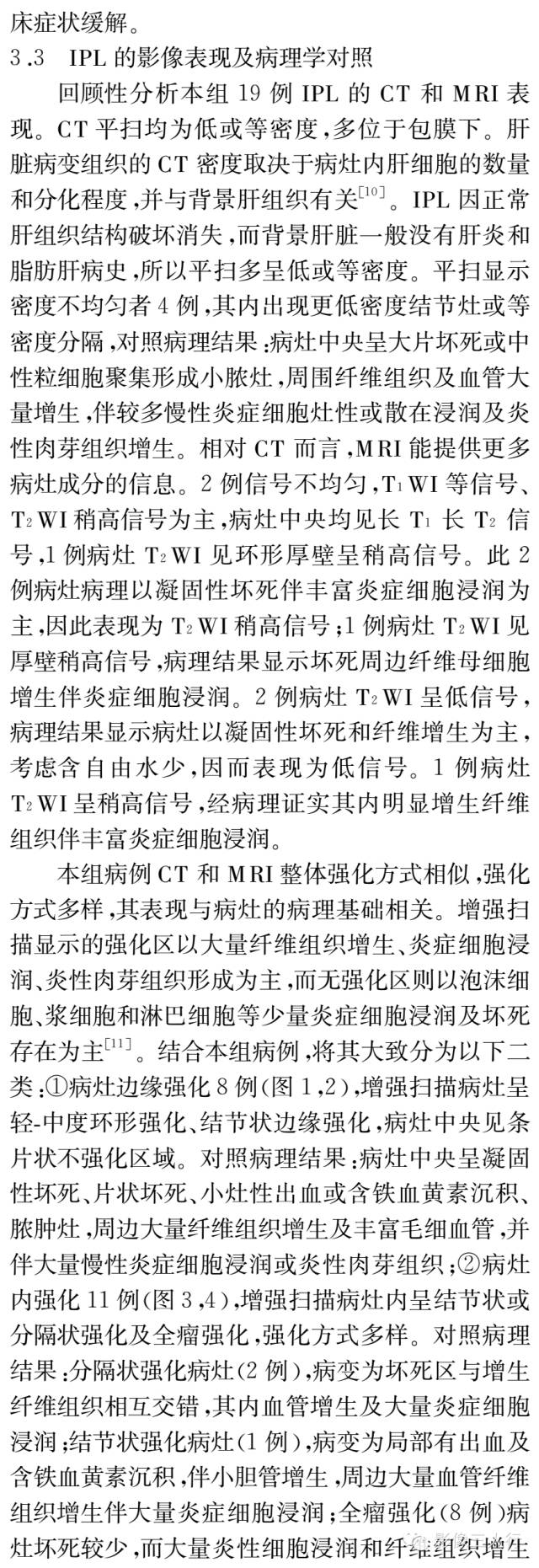 肝脏炎性假瘤的影像表现与病理对照分析
