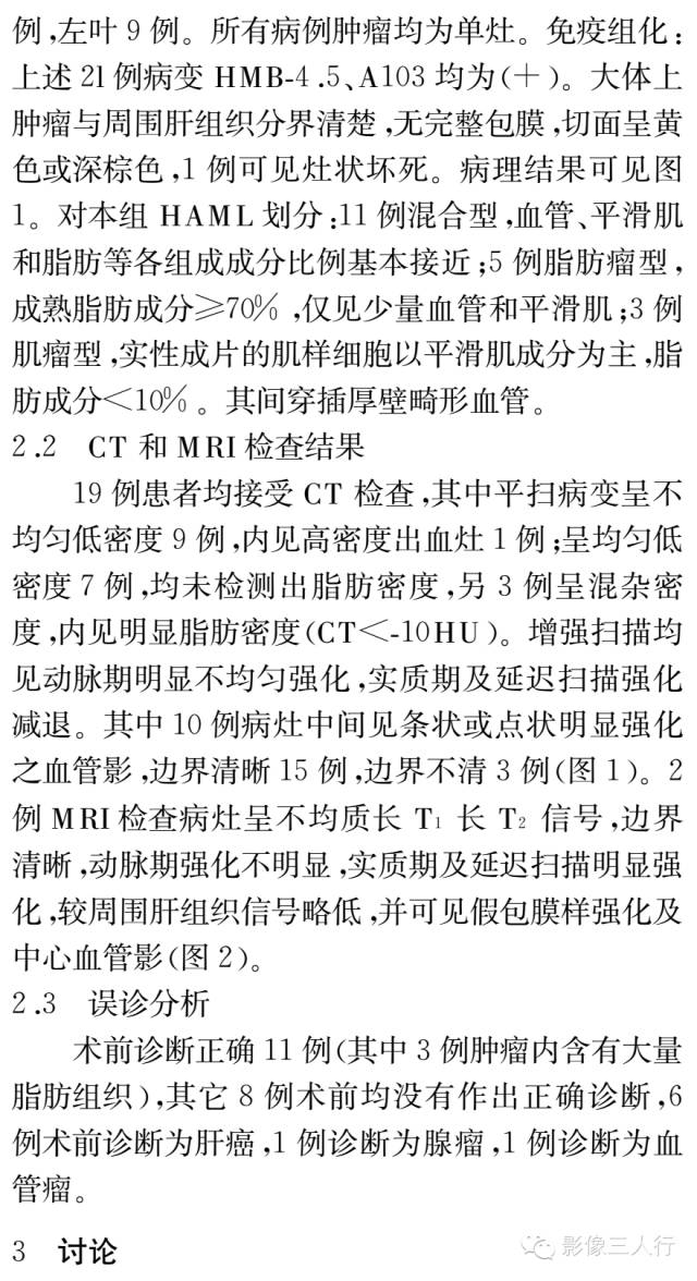 肝血管平滑肌脂肪瘤的CT和MRI表现及临床价值分析