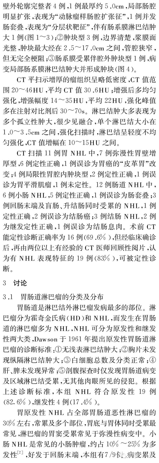 胃肠道非霍奇金淋巴瘤的分布与CT诊断