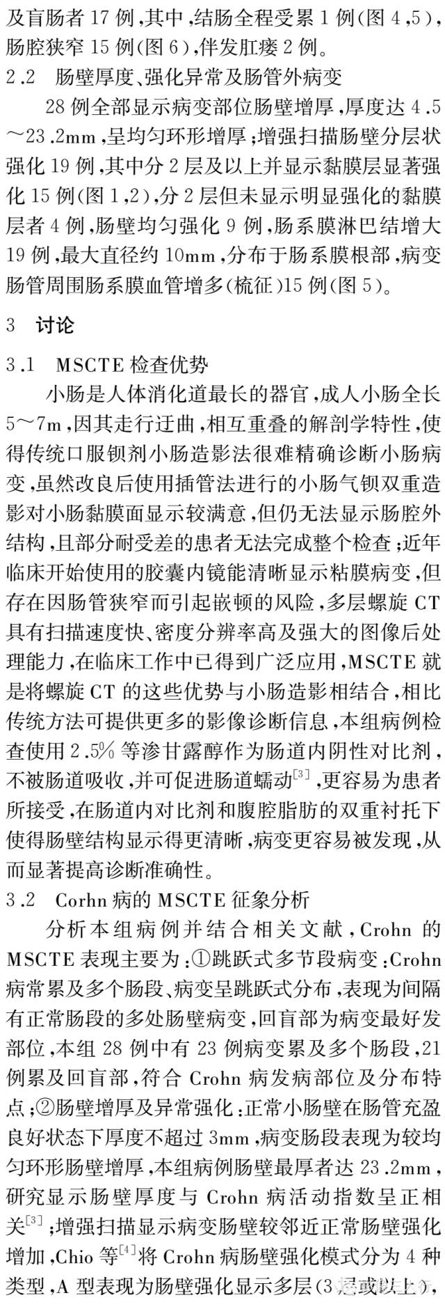 Crohn病的多层螺旋CT小肠造影征象分析