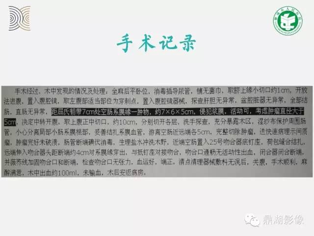 【病例】小肠胃肠道间质瘤1例CT影像表现