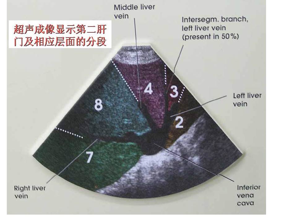 幻灯片25
