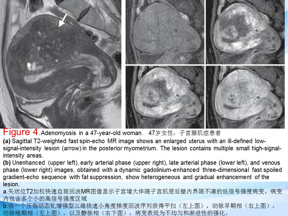 幻灯片14