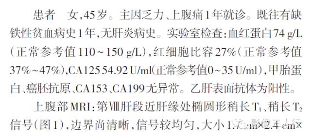 【病例】肝脏反应性淋巴样组织增生MRI表现一例