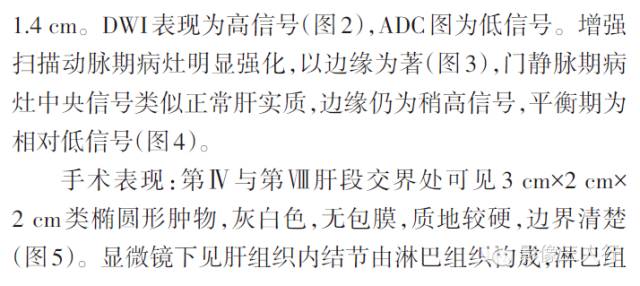【病例】肝脏反应性淋巴样组织增生MRI表现一例