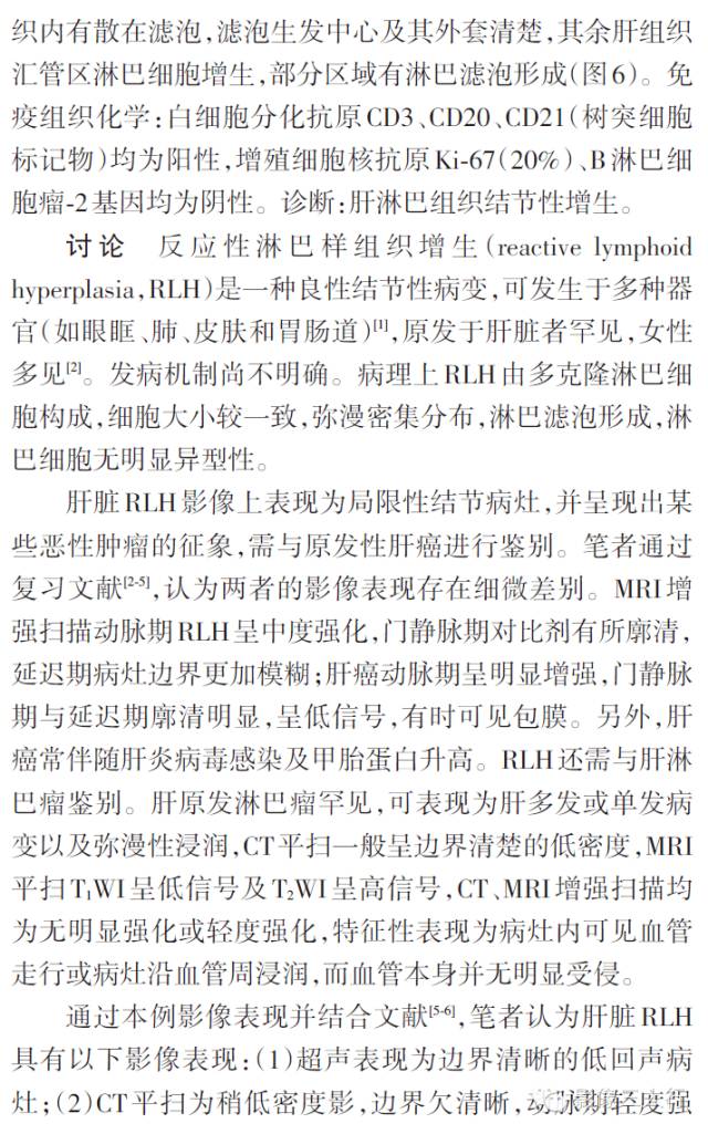 【病例】肝脏反应性淋巴样组织增生MRI表现一例