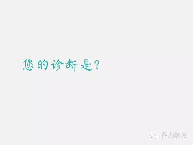 【病例】巨大腹主动脉瘤破裂1例CT影像表现