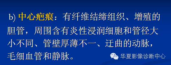【PPT】局灶性结节增生的影像表现