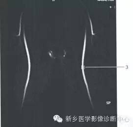 血管和MRCP一些正常影像数值