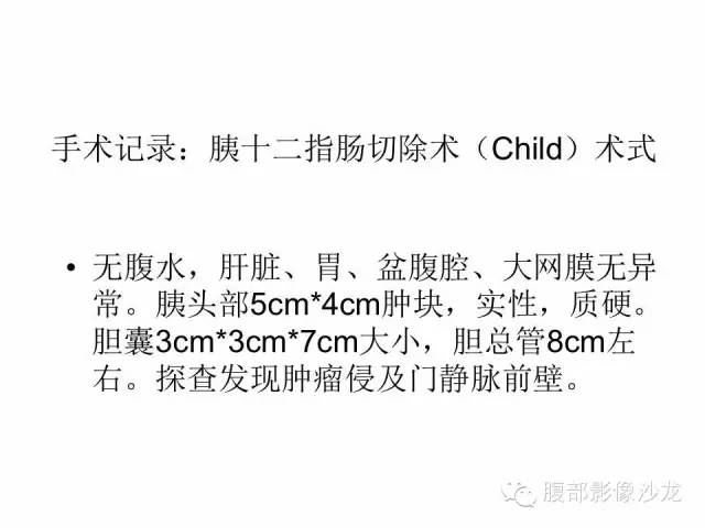 【病例】沟槽型胰腺炎1例影像表现