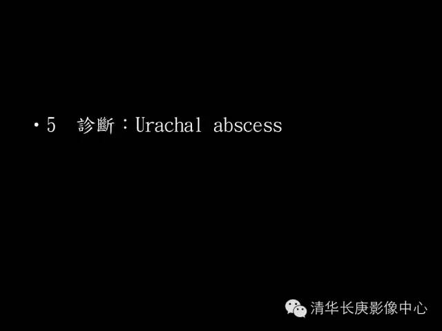【病例】脐尿管脓肿1例影像表现