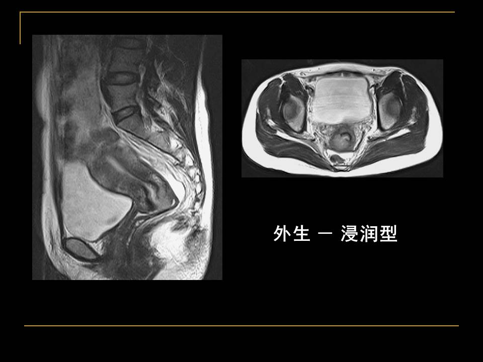 幻灯片23