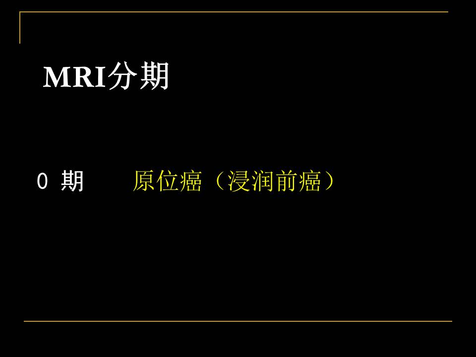 幻灯片25