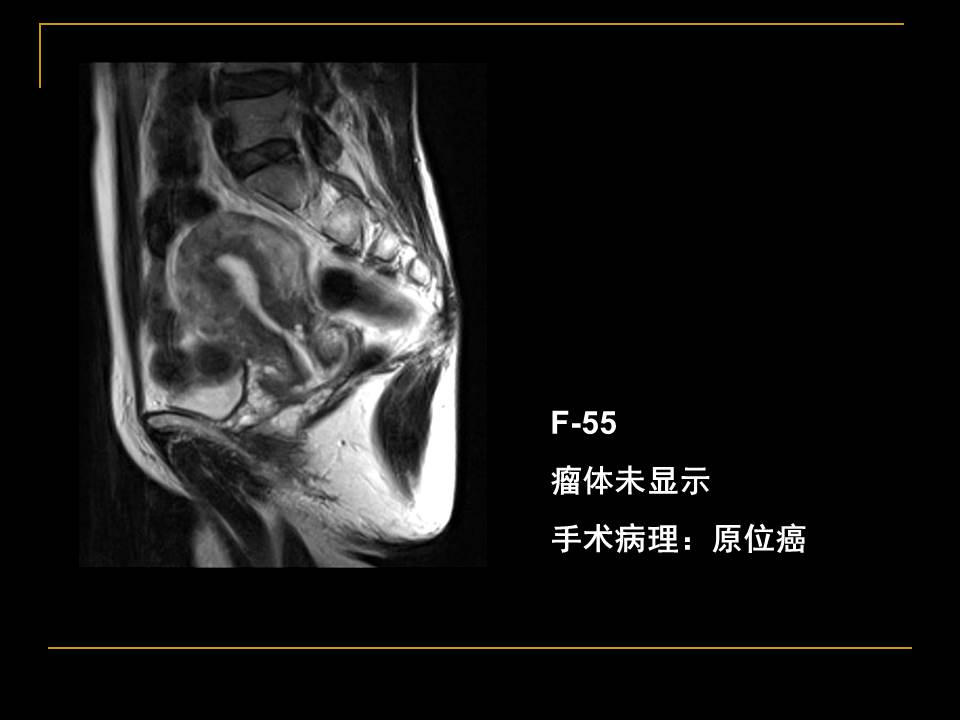 幻灯片30