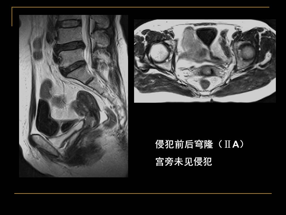幻灯片33