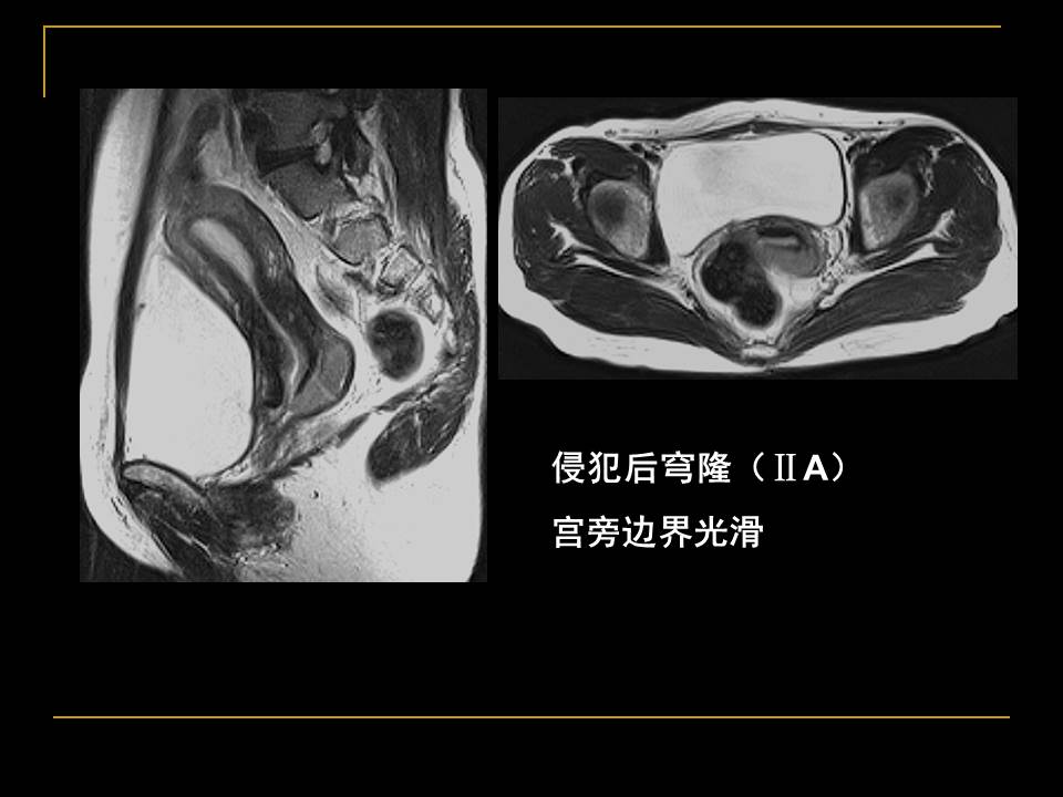 幻灯片34